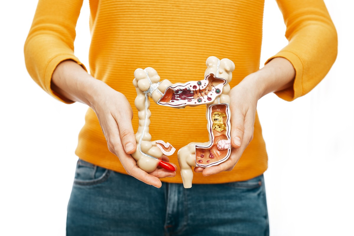  Gut Microbiome and Estrogen Metabolism: How Gut Health Affects Hormones
